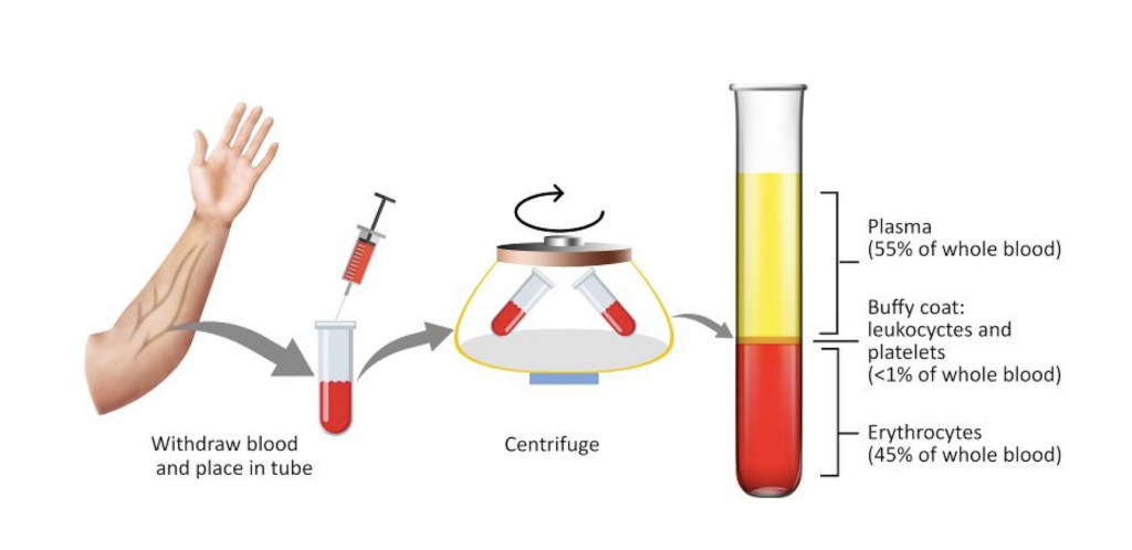 PRP Treatment Diagram