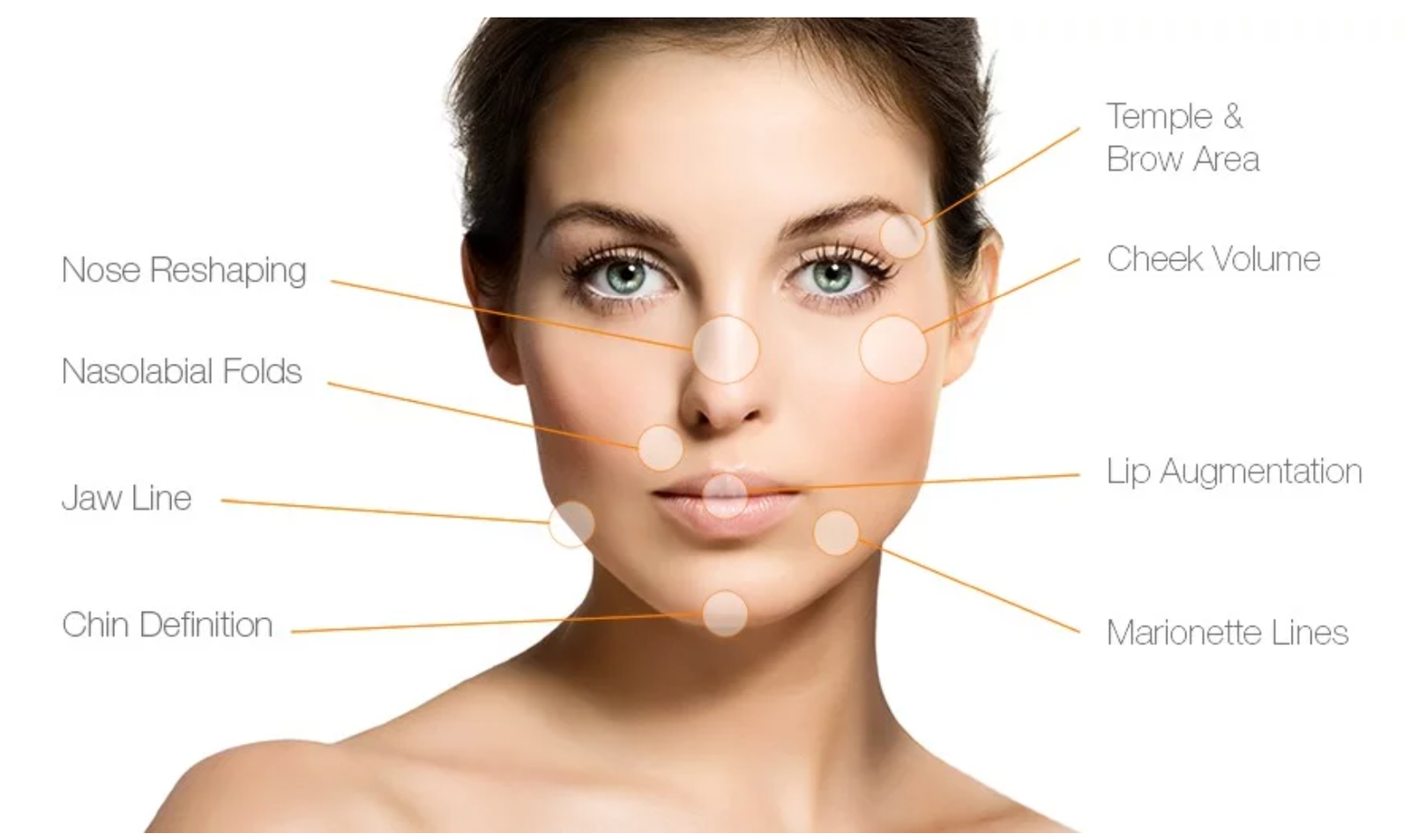 Dermal Filler - Mon Visage Health